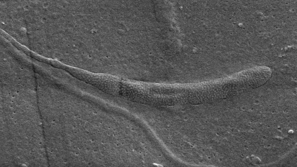 Discover the world's oldest animal sperm in Antarctica