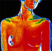 Discovered proteins help fight breast cancer