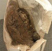 Discovered the oldest Egyptian mummy with chronic heart disease in the world