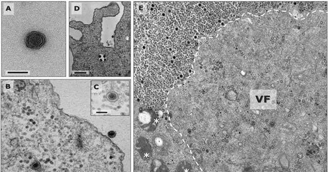 Discovered the 'water god' virus, which has an unknown gene
