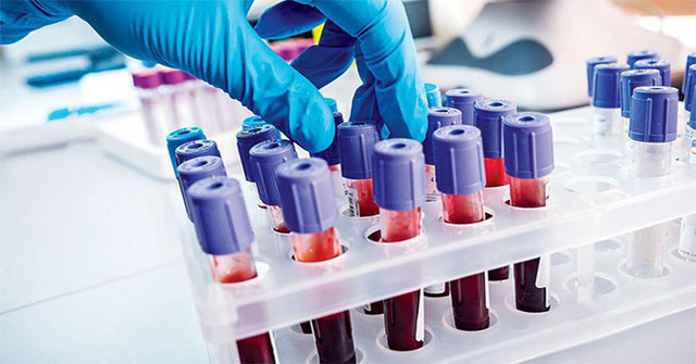 Discovering extremely ugly 'ugly' cholesterol