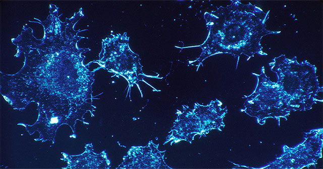 Discovering factors in the body that make cancer cells 'kill themselves'