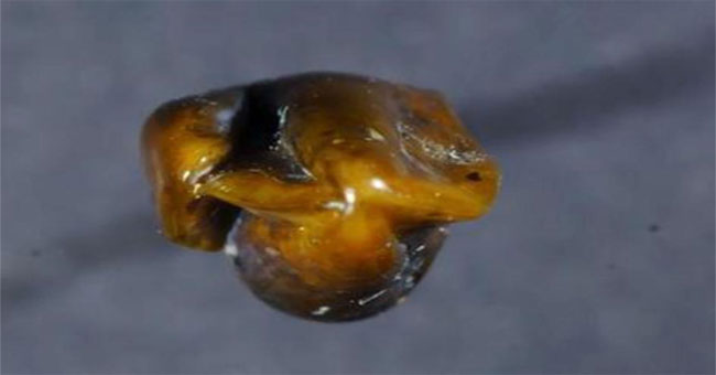 Discovering fossil teeth mysterious 9.7 million years old in Germany