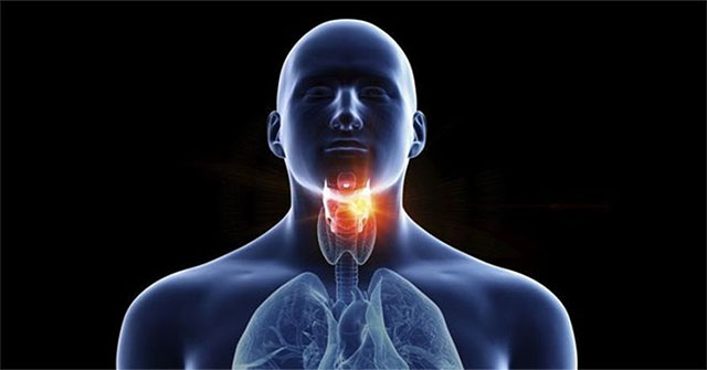 Distinguish common throat and throat cancer