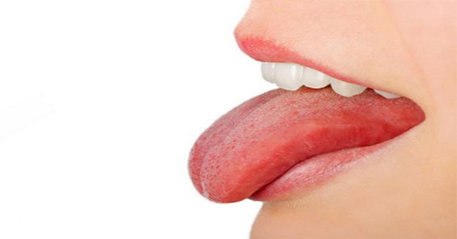 Do not confuse tongue cancer and mouth heat