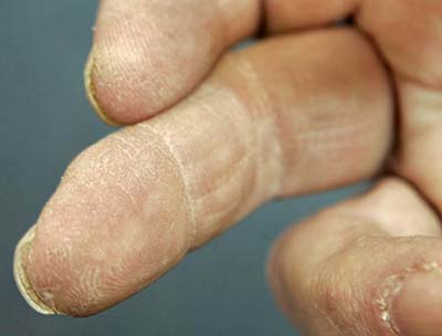 Do the impossible: Regrow amputated fingers