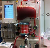 Doctors find new ways to preserve and transplant heart