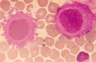 Does the natural selection mechanism make cancer develop?