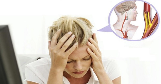 Don't be subjective with headaches when the weather changes