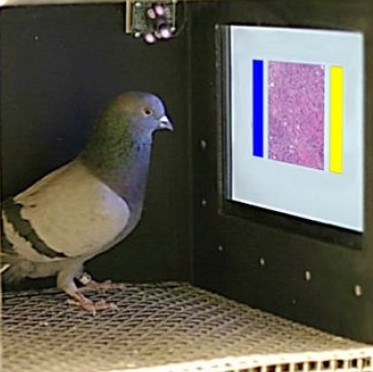 Dove diagnoses standard breast cancer like a doctor