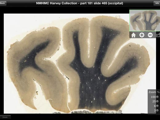 Download Einstein's brain image
