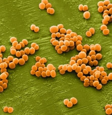 Drug resistance of the virus