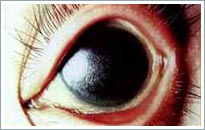 Dry eye disease and unpredictable hazards