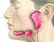 Dry eye syndrome