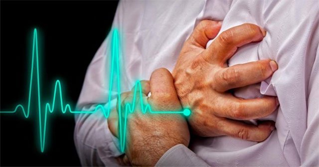 During the Covid-19 season, these people easily died of ... myocardial infarction