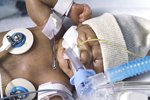 Early birth rate increases