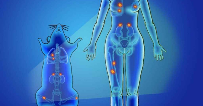 Early detection of more than 100 types of cancers thanks to nano optics