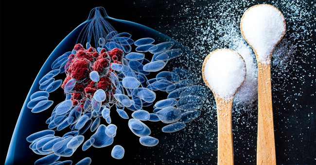 Eating lots of sugar stimulates cancer cells to grow