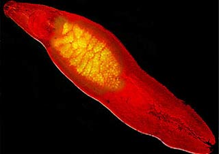 Eating raw fish is prone to liver cancer