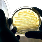 E.coli bacteria can produce diesel