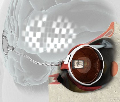 Electronic eyes: add bright hope for blind people