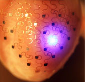 Electronic shell for the heart