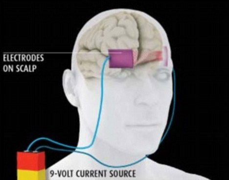 Electrophysiological stimulation enhances the ability to learn