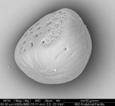 Elevated carbon dioxide makes the ear bones unusually large