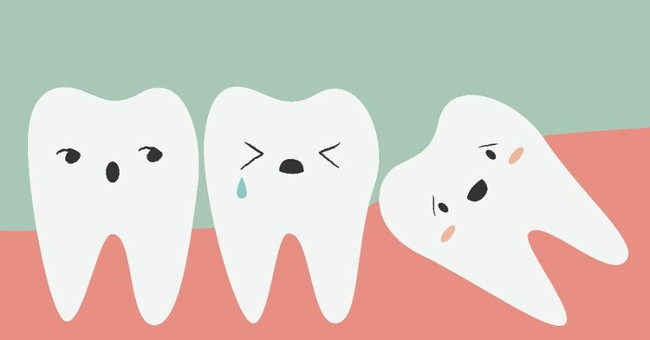 Eliminate false thoughts about wisdom tooth extraction