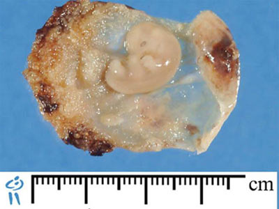 Embryo production of teratogens - Contrary ideas