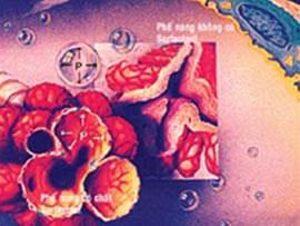 Endothelial disease in newborns