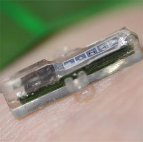 Equipment tiny blood tests under the skin