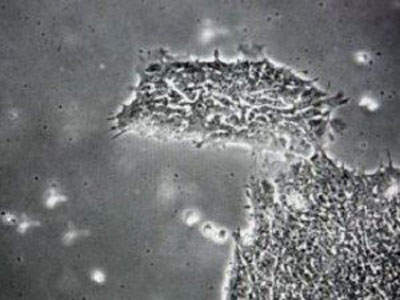 Evidence of the existence of cancer stem cells