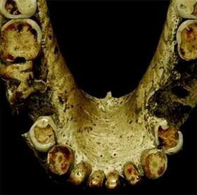 Evidence shows that the ancients knew how to use toothpicks to