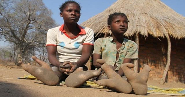 Exotic legs of ostriches in Africa