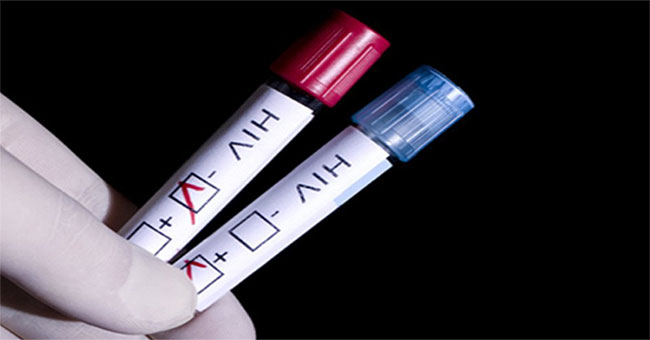 Experience in HIV testing you need to know