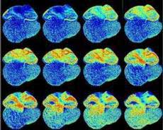 Experimental mice have glowing hearts