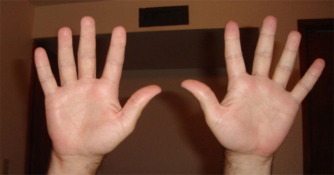 Explain the cause of human having 10 fingers