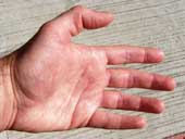 Explain the phenomena of the body