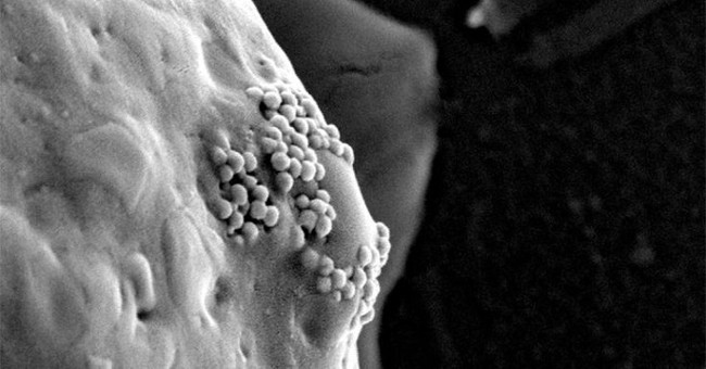 Explosive gold nanoparticles can eradicate cancer cells to the root