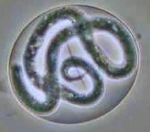 Eye disease caused by worms only