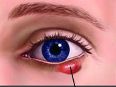 Eye protection
