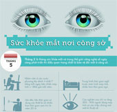 Eyes health at work