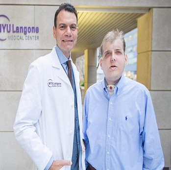 Face transplants startling the world