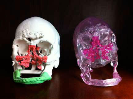 Facial injury surgery with 3D technology