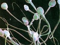Factors affecting sperm