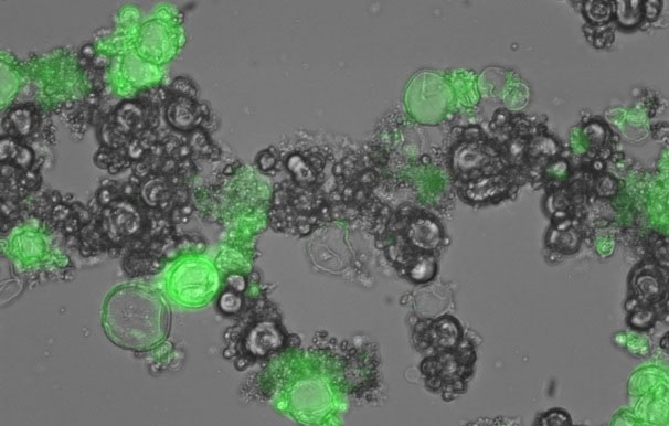 'Factory' produces cancer drugs right in the body