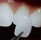 Feed real teeth from cells