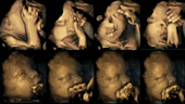 Fetal reaction when mother smokes