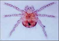 Fever disease